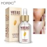 Сыворотка ROREC Rice White Skin Beauty, 15 мл (106)