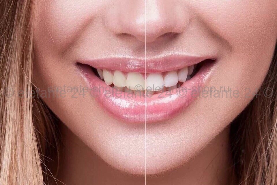 Зубная паста для бережного удаления зубного камня Amore Pacific MEDIAN 86% Toothpaste blue (125)