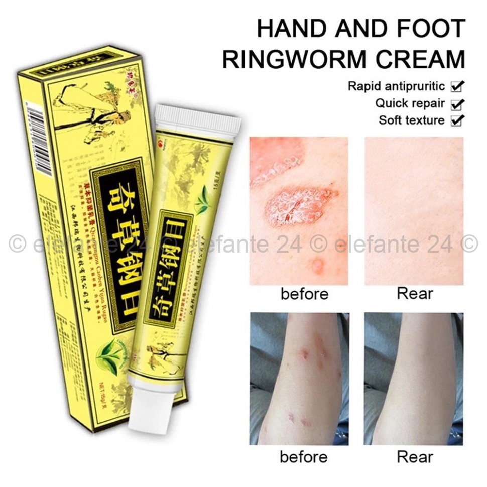 Крем против заболеваний кожи Hand and Foot Ringworm Cream 15g (106)